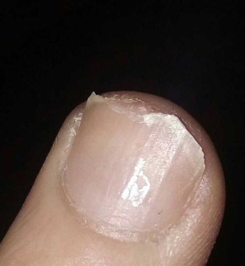 佳能锡纸泛白的原因是什么？如何处理泛白问题？