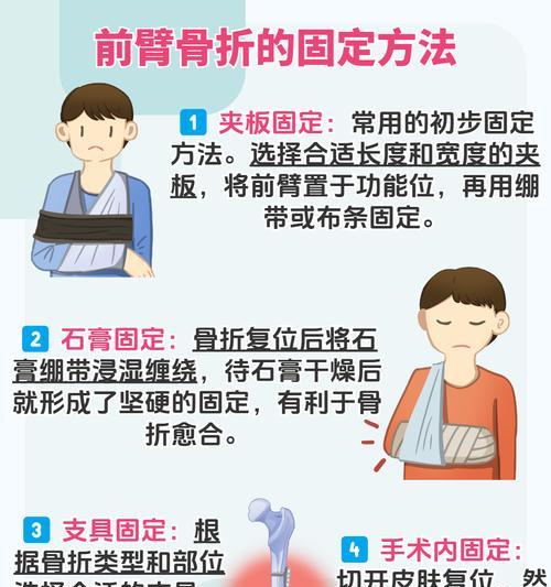 手臂托架的正确使用方法是什么？